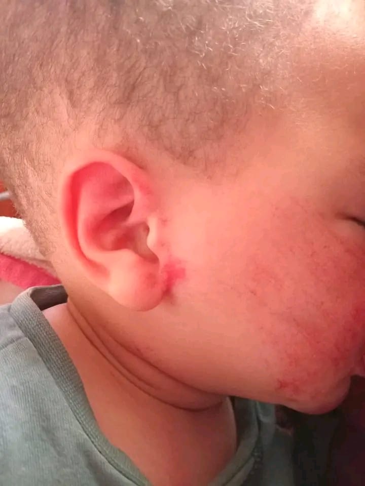 Breaking News:  Two-Year-Old Boy Brutally Assaulted in Wolseley